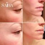 سرم آبرسان و جوانساز بافت اوردینری - تصویر 3