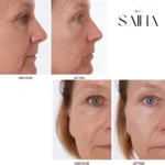 سرم آبرسان و جوانساز بافت اوردینری - تصویر 2